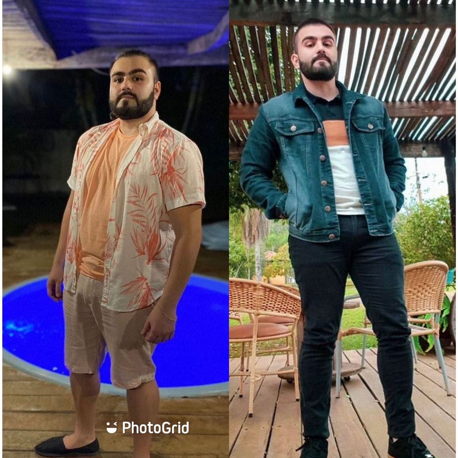 Duas fotos do mesmo paciente, de corpo inteiro, em dois momentos do acompanhamento nutricional (6 de 9)
