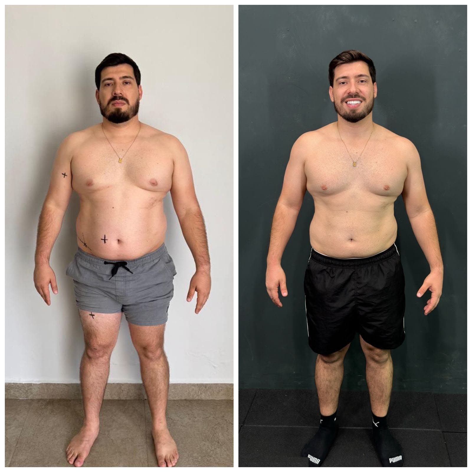 Duas fotos do mesmo paciente, de corpo inteiro, em dois momentos do acompanhamento nutricional (9 de 9)
